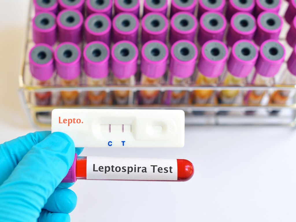 Leptospira test tube